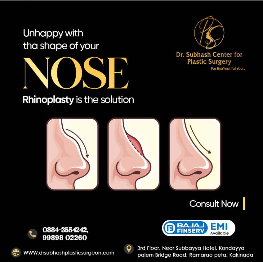 Unhappy with Your Nose Shape? Rhinoplasty is the Answer for a New You