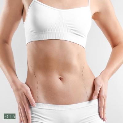 Abdominoplasty in Dubai- Ecla Clinic