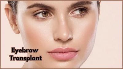 Eyebrows Transplant in Gurgaon at SB Trichology