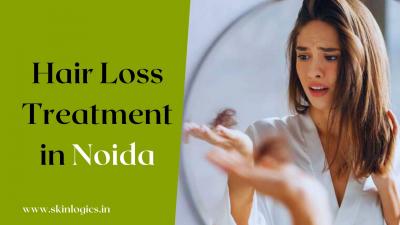 Hair Fall Doctor in Noida