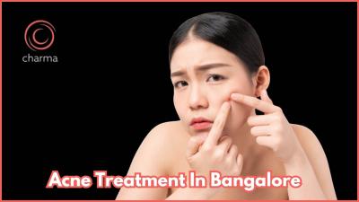 Acne Treatment in Bangalore - At Charma Clinic