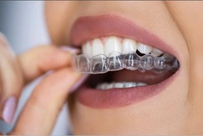 Invisalign General Dentistry in UK