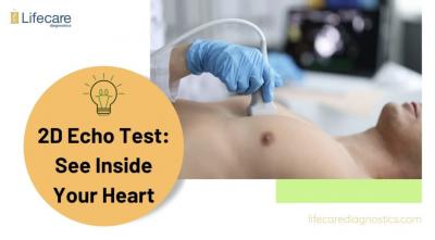 2D Echo Test: Heart Health Evaluation