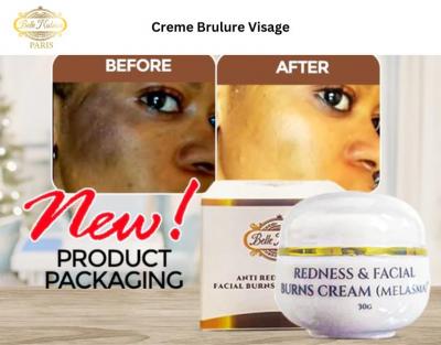 Creme Brulure Visage à Bas Prix