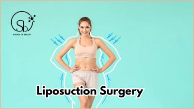 Best Liposuction Surgery in Bangalore