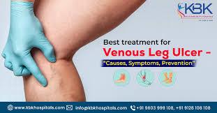 venous ulcer treatment in hyderabad