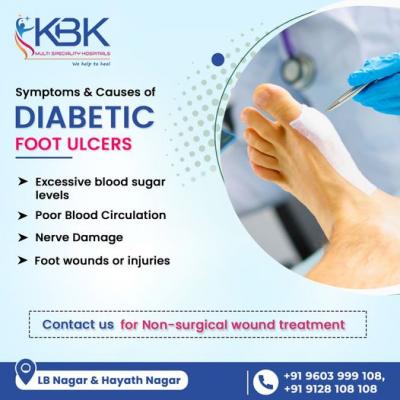 Best diabetic foot surgeon in hyderabad