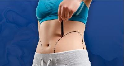 Coolsculpting | Inch Loss with Fat Freezing Lose Belly Fat | Muscle Toning