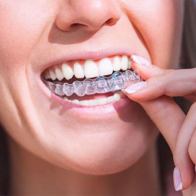 Experience The Best Teeth Whitening In Red Deer  At Delta Dental 