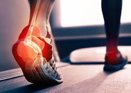 Achilles Tendonitis Treatment Center - New York Other