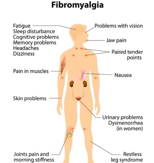 Ayurvedic treatment for fibromyalgia - Sydney Other