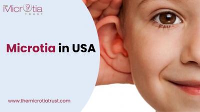 Microtia in the USA