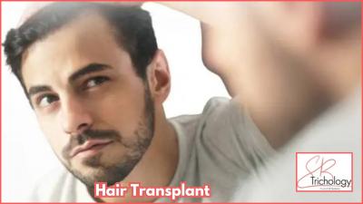 Hair Transplant Cost in Gurgaon | SB Trichology Clinic 