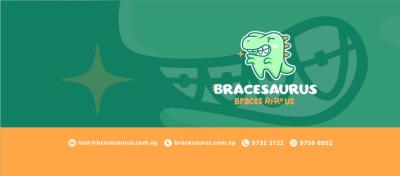 Invisible Braces in Singapore: A Discreet Solution for a Beautiful Smile - Singapore Region Other