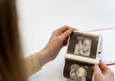 4d sonography in pregnancy - Ahmedabad Other