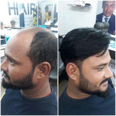 Wig Shop in Bhubaneswar - Other Other