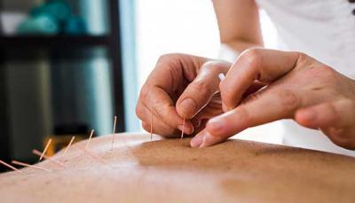 Dry needling nyc