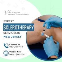 Expert Sclerotherapy Services in NJ