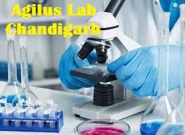 Agilus Lab Chandigarh - Chandigarh Other