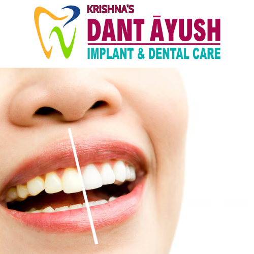 Top Dental Clinics in Hyderabad