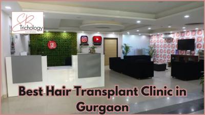 Best Hair Transplant Clinic In Gurgaon