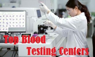 Top Blood Testing Centers - Chandigarh Other