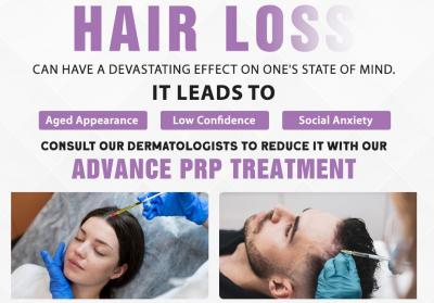 Hair loss treatment for men and women in dehradun