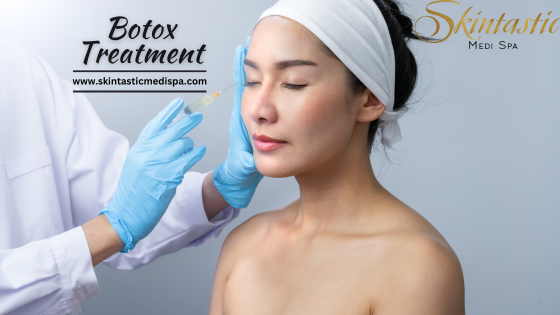 Youthful Skin with Botox in Riverside