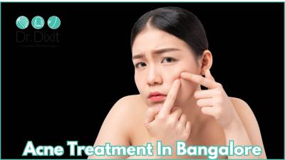 Acne treatment in Bangalore