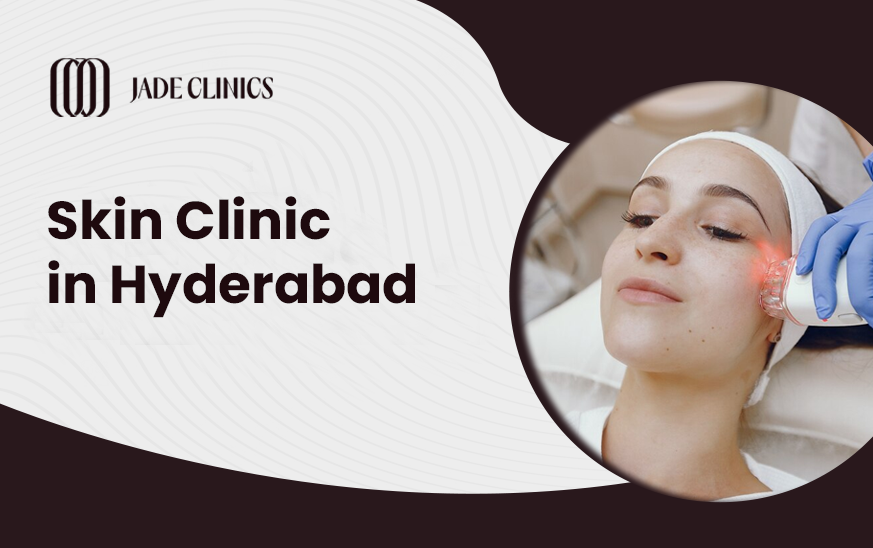 skin clinic in Hyderabad - Delhi Health, Personal Trainer