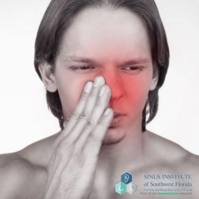 Sinus Headache Treatment In Fort Myers FL