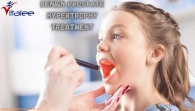 Trusted Benign Prostate Hypertrophy Treatment Specialists