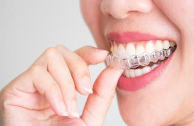 Washington, DC Invisalign - Other Health, Personal Trainer