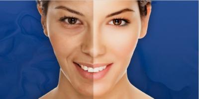 Glutathione Injection for Skin Whitening in Santacruz West – Cost & Skin Whitening Injection