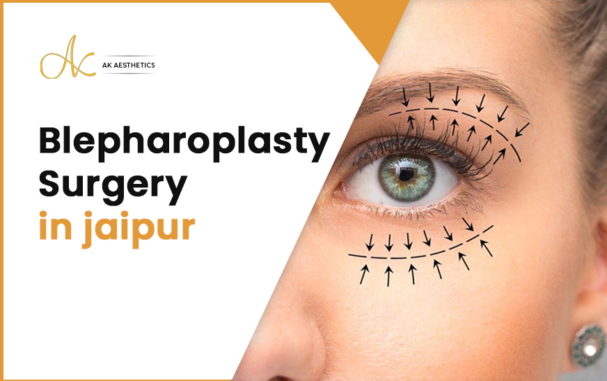 Blepharoplasty Surgery in Jaipur |Dr Akangsha Sharma