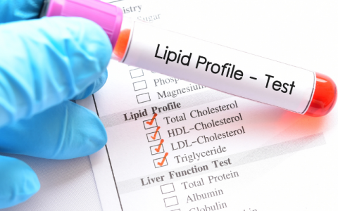 Lipid Profile Test Price