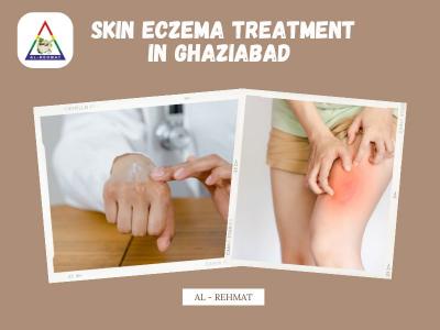 Skin Eczema Treatment in Ghaziabad - AL - Rehmat