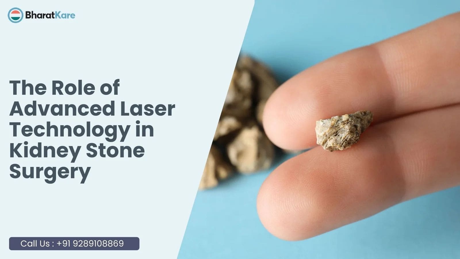 The Role of Lasers in Technology in Kidney Stone Treatment