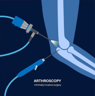 Arthroscopy Surgery in Punjab: Expert Care for Joint Health