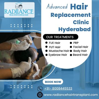 Trusted Hair Transplant Experts in Hyderabad - Hyderabad Other