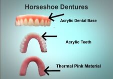 DENTURE KIT/U-DENTURES HORSESHOE UpperDentures Impression Kit Included